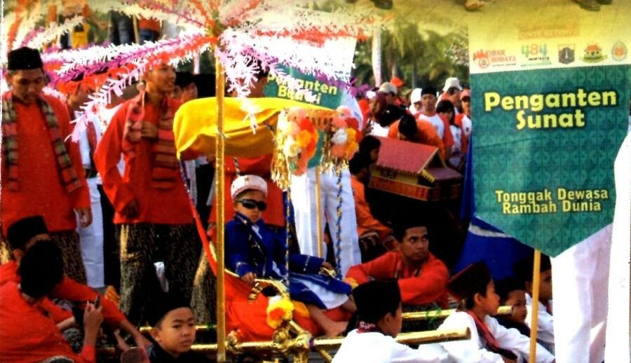 Dibalik Sakit dan Ngilunya Sunat, Ada 5 Nikmat Luar Biasa yang Akan Didapat