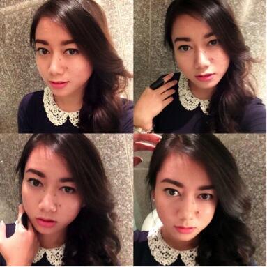 Cewek Bertahi Lalat di Wajah, Cantik atau Mengganggu?