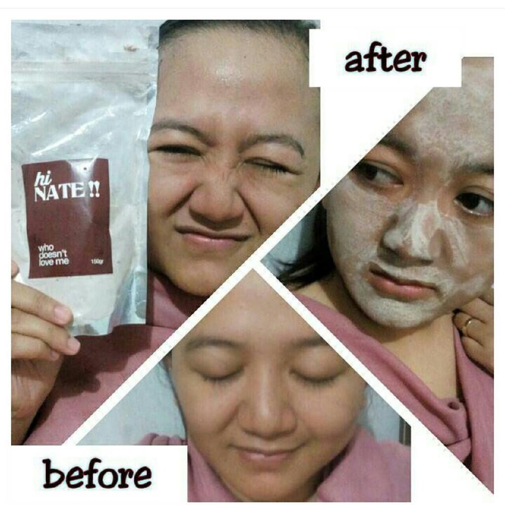 Dicari Reseller Brownis Masker Ni ! Nate