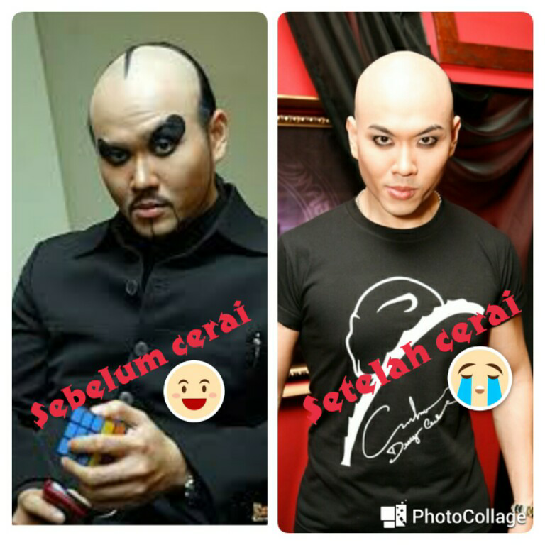 Keuntungan Berkepala Botak (Oom Mau Cukur Rambut Nih)