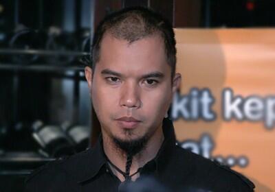 Ruhut: Kodok dan Kecebong Jokowi Saja Ketawa Lihat Rambut Ahmad Dhani