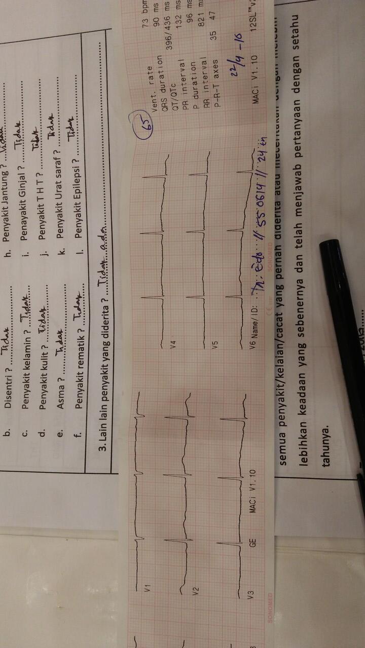 Download 9300 Koleksi Gambar Hasil Ekg Normal Terbaik HD