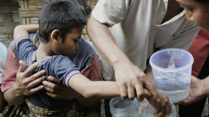 Inget Ponari si dukun cilik yg dulu kaya raya? Begini nasibnya sekarang...