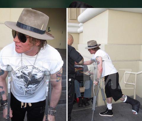 Axl Rose, Sang Vokalis Legend Mengalami Patah Kaki Saat Tour Reuni Guns N' Roses