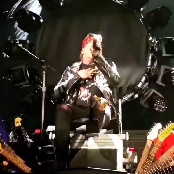 Axl Rose, Sang Vokalis Legend Mengalami Patah Kaki Saat Tour Reuni Guns N' Roses