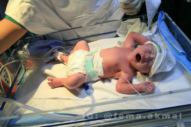 UPDATE NEWS Proses Kelahiran anak Ke-2 Melaney Ricardo EKSLUSIVE