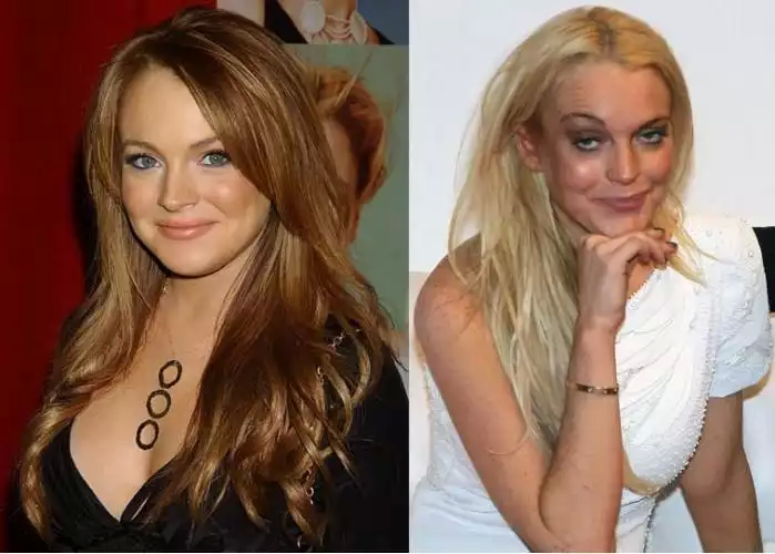 7 Wajah Selebriti Setelah Pakai Narkoba