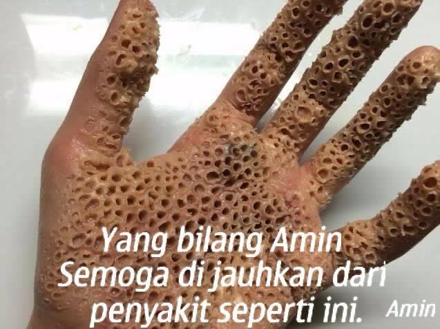 Subhanallah, Ada Suara Zikir dari Dalam Sumur di Idi Rayeuk