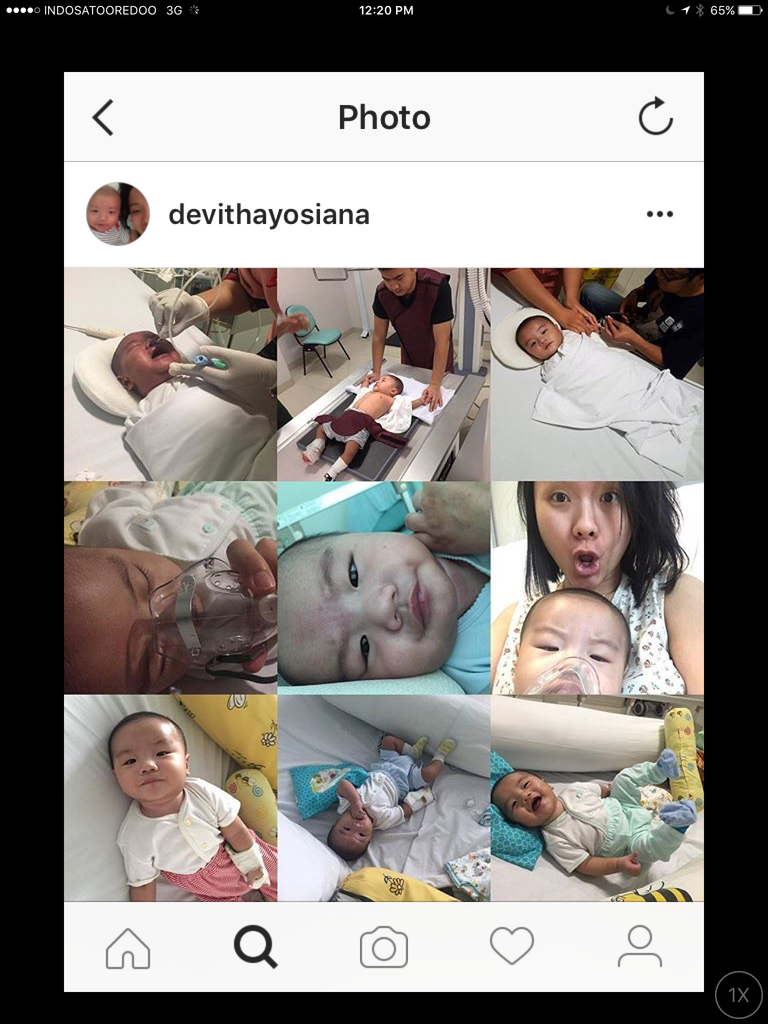 &#91;NEED HELP&#93; Galang Dana utk Baby Iron, bayi dengan Congenital Heart Defect