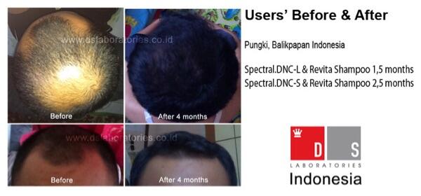 Spectral DNCS serum penumbuh rambut pria wanita (minoxidil free)