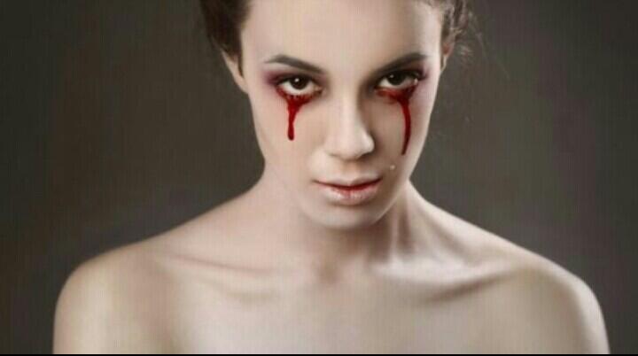 Penyakit-Penyakit Mata Yg Mengerikan