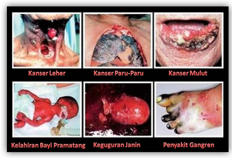 Tak Mempan, gambar bahaya merokok diminta diperbesar