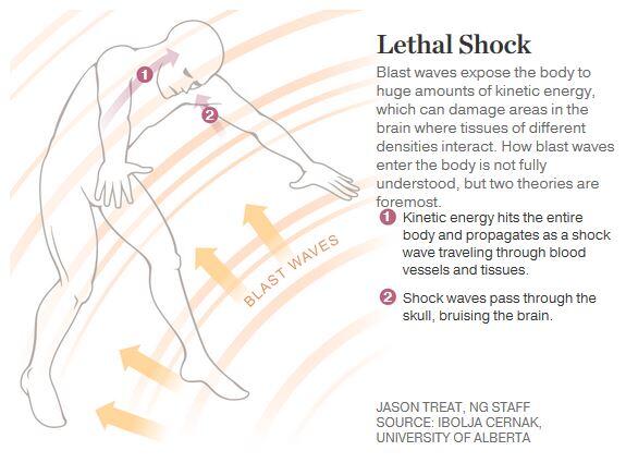 'Shell Shock'—The 100-Year Mystery May Now Be Solved