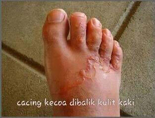 Di dalam Tubuh Kecoa terdapat Sejenis Cacing halus/lembut ?