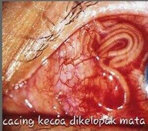 Di dalam Tubuh Kecoa terdapat Sejenis Cacing halus/lembut ?