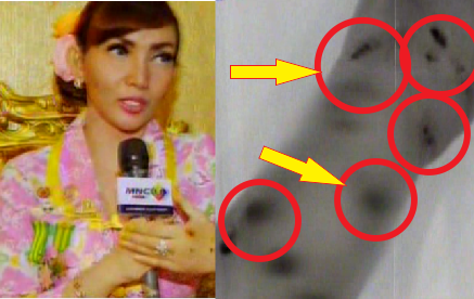 HEBOH ! Mengaku Kena Serangan SANTET, Tangan Roro Fitria Gosong