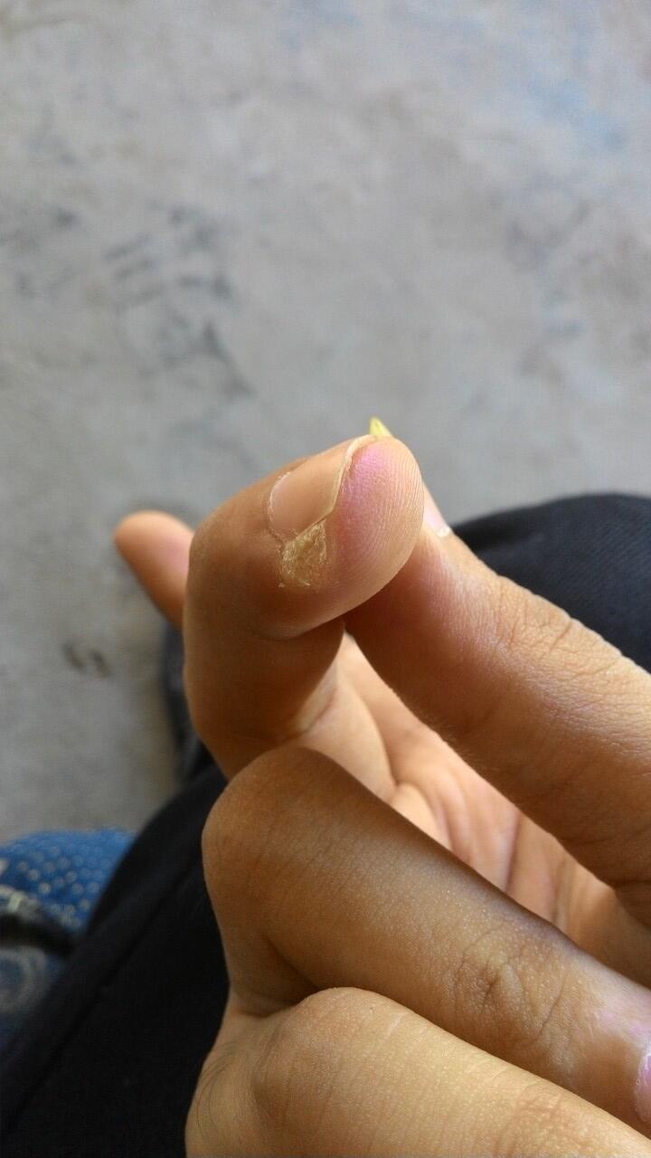 HELP bantu infonya soal penyakin saya ini (kulit)