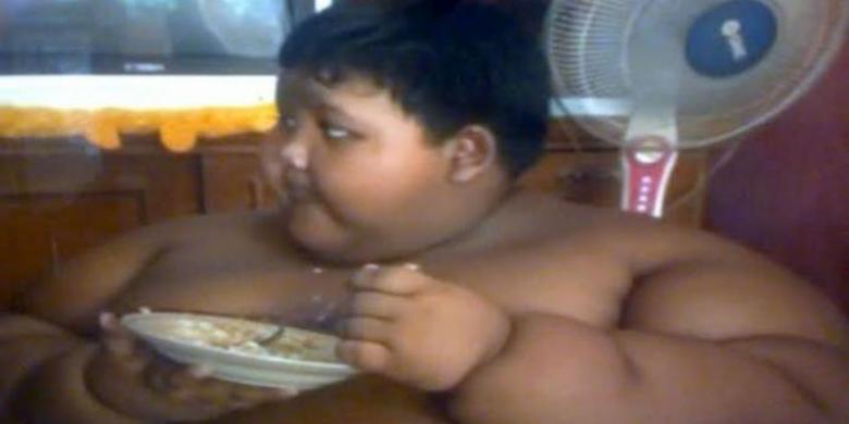 Bobot Mencapai 140 Kg, Bocah 10 Tahun Tak Bisa ke Sekolah Lagi 