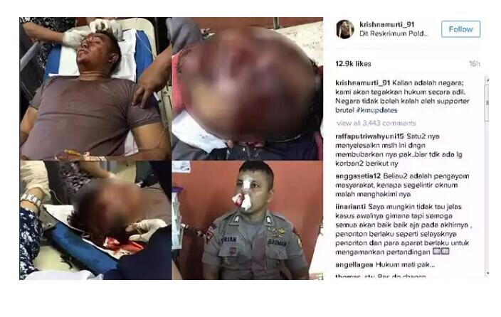 Krishna Murti Posting Foto Polisi Luka Parah dan ‘Pak Tua’ Yang Dihajar Hingga Tewas 