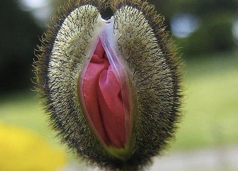 Penyebab Organ Genital Wanita Sering Gatal