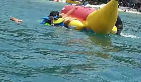 Kemaluan Wanita Ini Robek Setelah Main Banana Boat