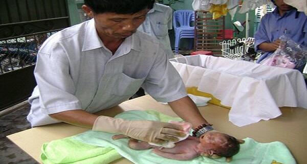 Pria Vietnam Memakamkan ribuan bayi aborsi &amp; menyelamatkan ratusan jiwa anak