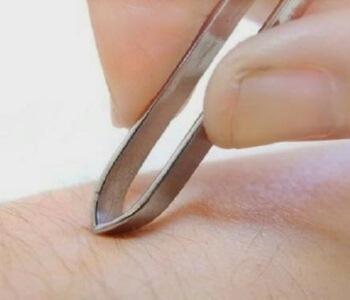 cabut bulu ketiak memicu kanker payudara