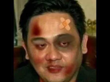 selasa pagi naik ojek onglen gan :mad