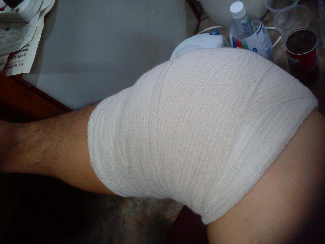 Bray gw ngobatin koreng pake BPJS ni bray