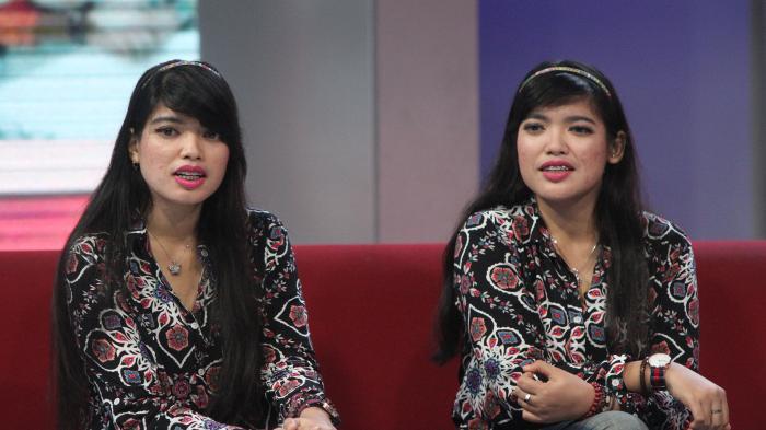 Kisah Kembar Siam Setelah 29 Tahun, Kerap Gunakan Pakaian Sama Meski Jarak Berjauhan