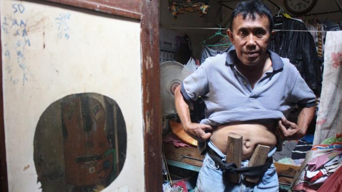 Miris! Altet Balap Sepeda Peraih Emas Ini Kini Menjadi Penarik Becak