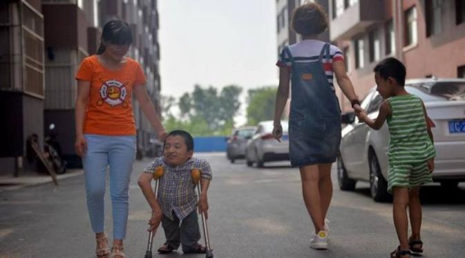Meski Fisik Tak Sempurna Kami Buktikan Cinta Sejati Itu Masih Ada