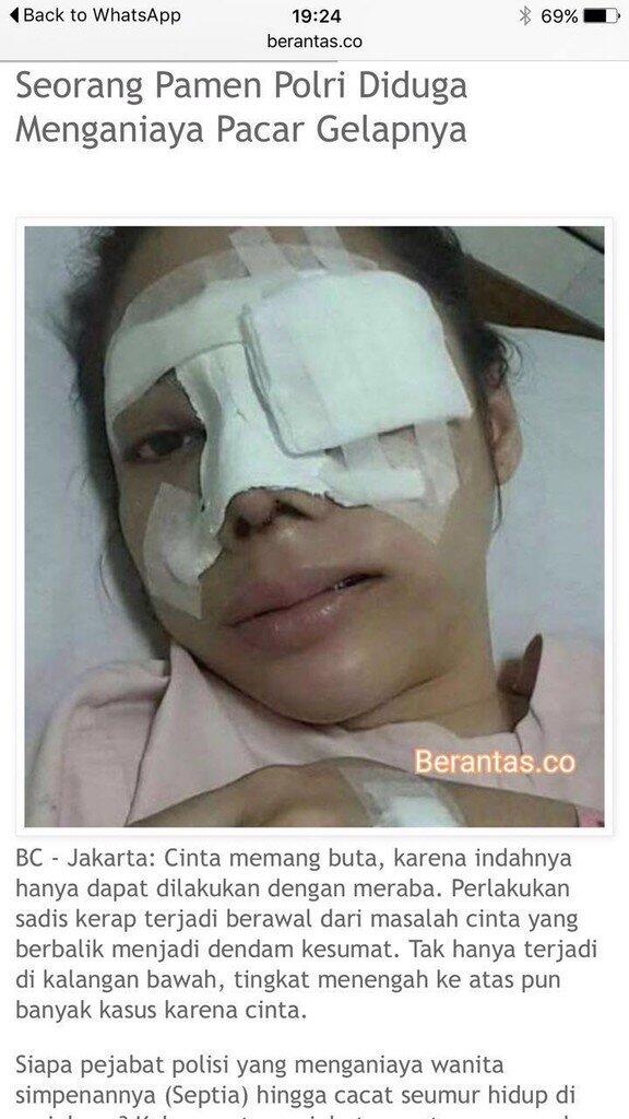 Propam Selidiki Info Kombes Krishna Murti Aniaya Teman Wanitanya