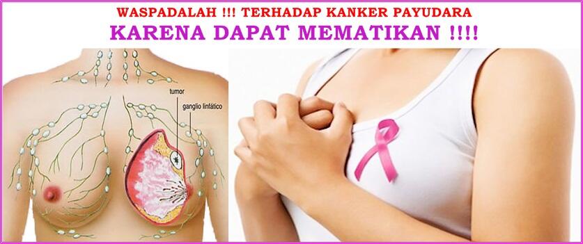 Waspada Kanker Payudara! Tidak Hanya Mengintai Wanita Lho Gan, Pria Juga!