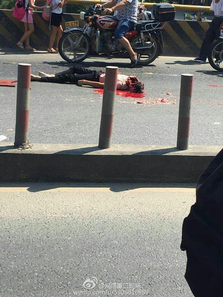 Misuh gini"Asu.... tanganku di gigit Asu..."