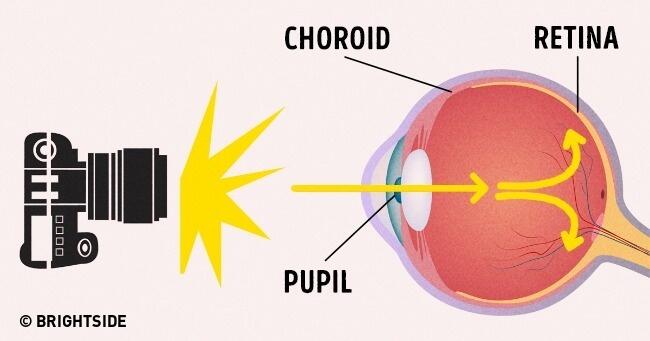 inilah alasan mengapa mata kita &quot;menyala&quot; saat difoto