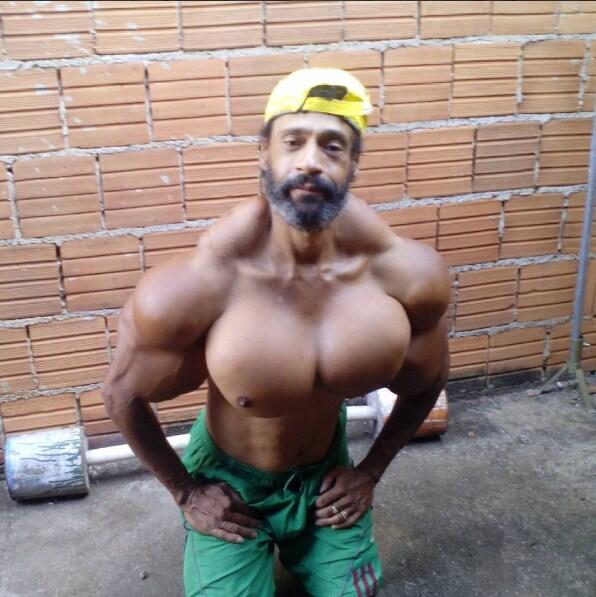 Suntik minyak ke tubuh, Pria ini jadi hulk