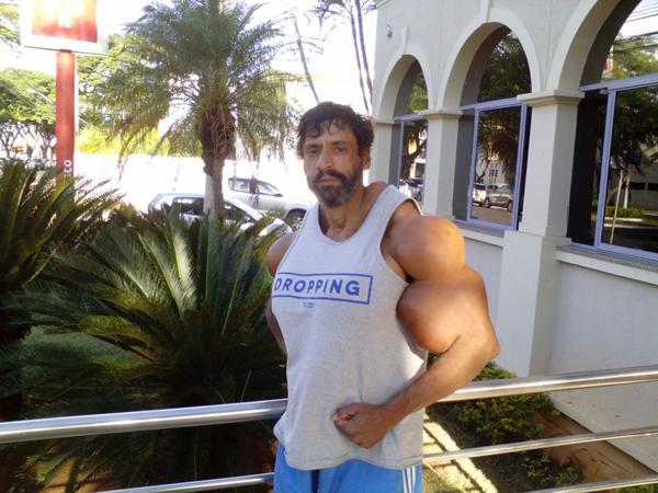 Suntik minyak ke tubuh, Pria ini jadi hulk