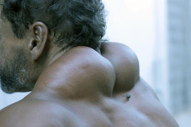 Suntik minyak ke tubuh, Pria ini jadi hulk