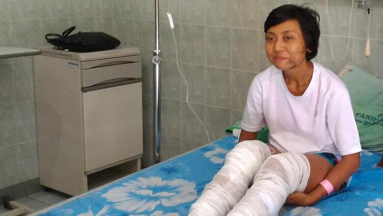 Pelari Lomba Lintas Gunung di Jawa Disiram Air Keras di Boyolali