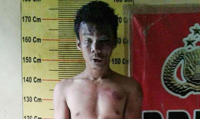 Korban Berteriak, Pemuda Ini Langsung Dipermak Warga, Hingga Kek Gini Kondisinya…