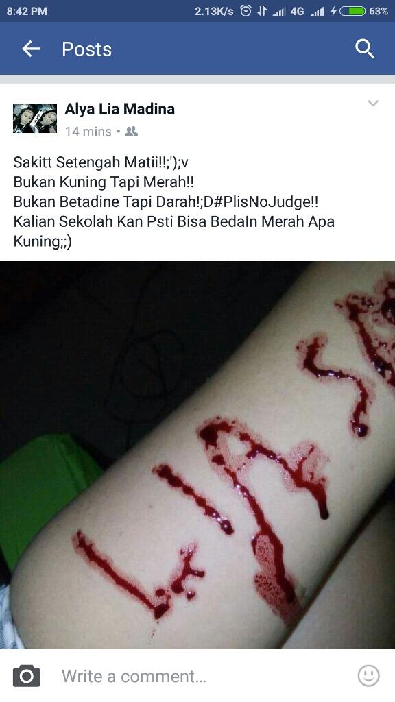 ketika abg alay mau drama silet tangan, tapi fail