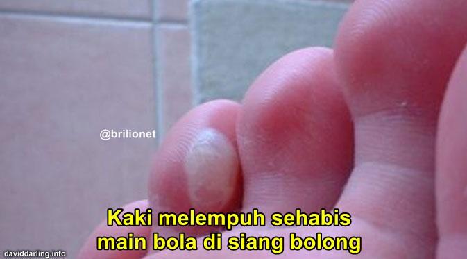 12 Momen sakit dalam hidup ini dijamin pernah agan alami