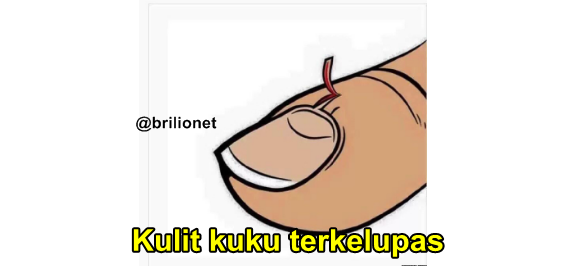 12 Momen sakit dalam hidup ini dijamin pernah agan alami