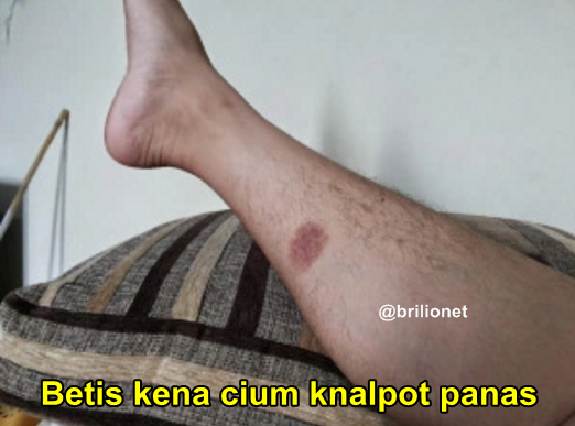 12 Momen sakit dalam hidup ini dijamin pernah agan alami