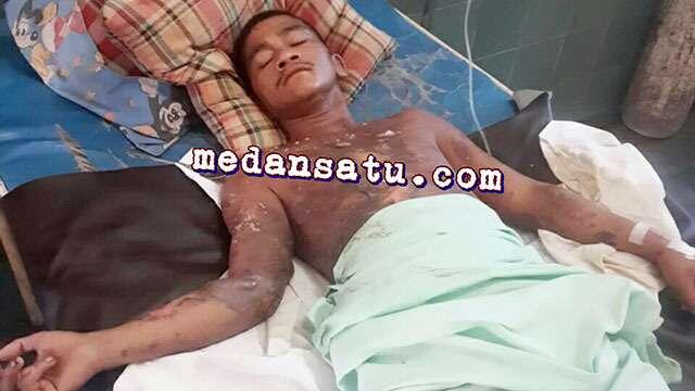 Tragis! Diikat Dipohon, Ucok Dibakar Hidup-hidup, Kepalanya Disabeti Rantai Anjing…