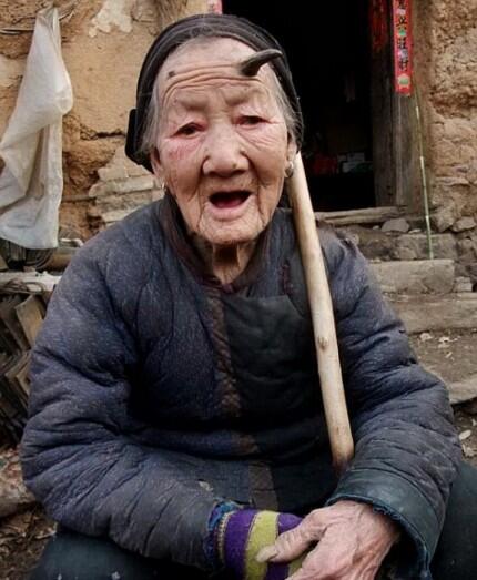 Nenek Usia 107 Tahun Memiliki Tanduk Di Dahinya