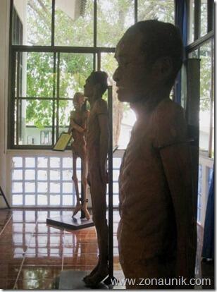 Metode Baru Gunting Molekuler untuk Pengobatan HIV AIDS