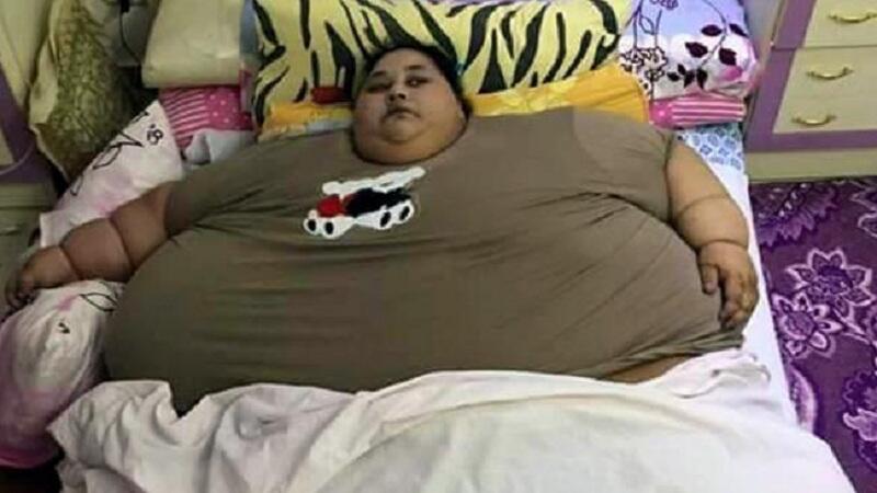 Kisah Pilu Wanita Tergemuk di Dunia