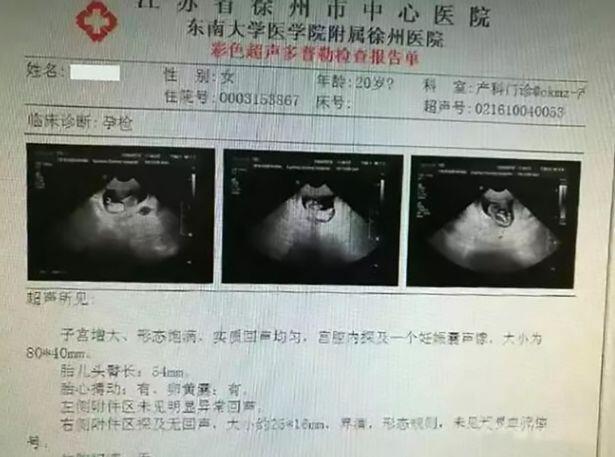Menghamili Putri 12 Tahun &#91;China&#93;